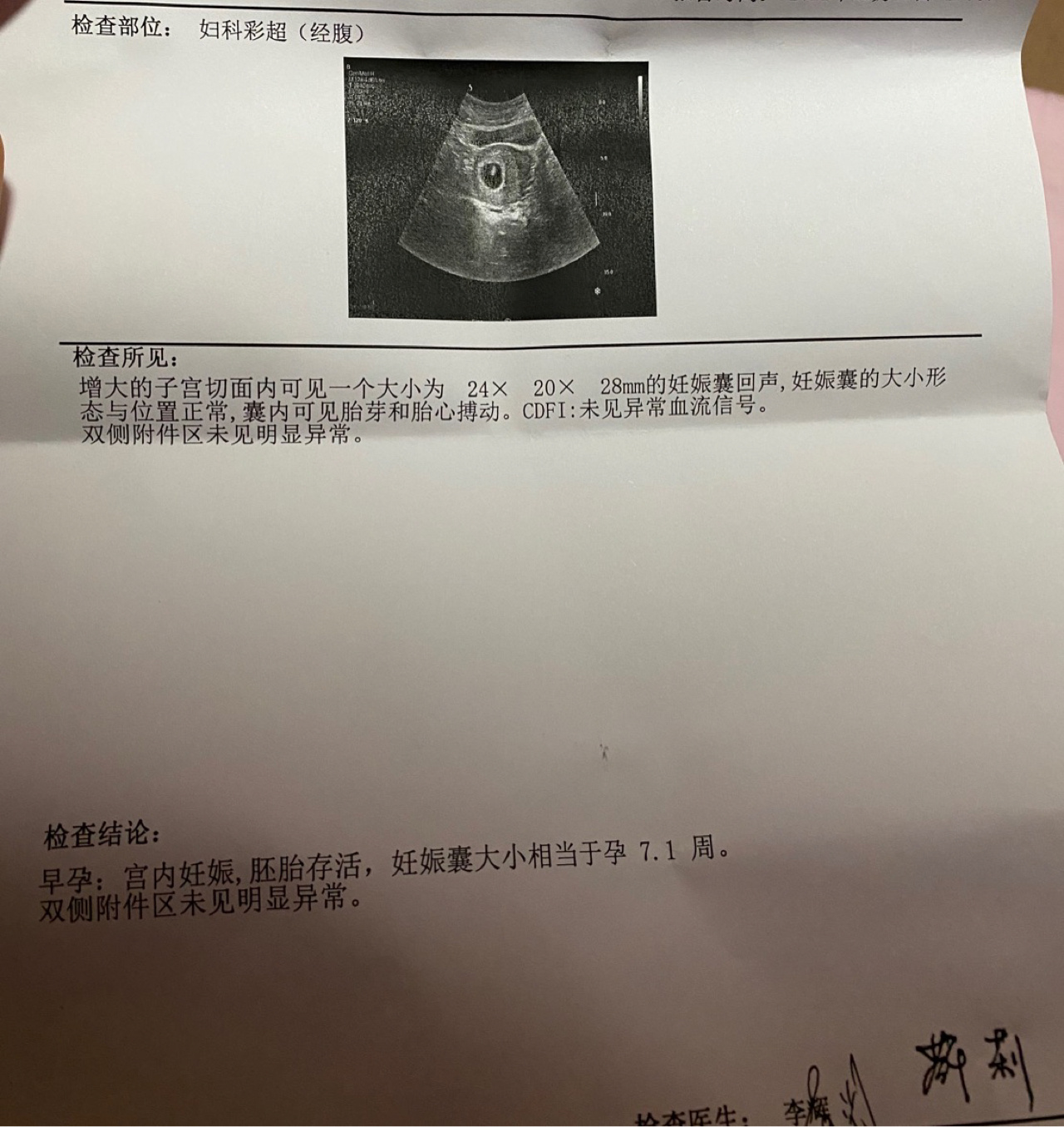 7周孕囊大小标准值
